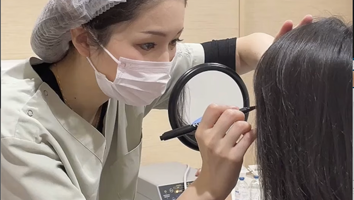 鼻翼縮小とは？