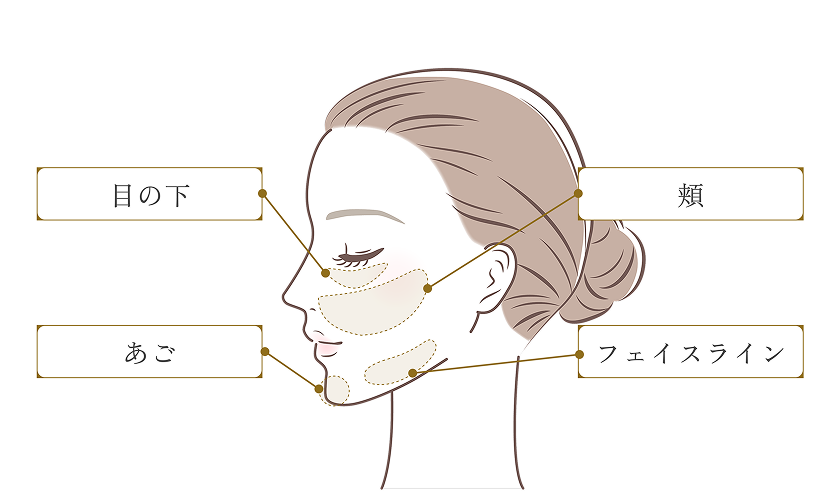 ボルニューマ