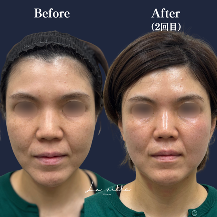 CASE 01 Before/After