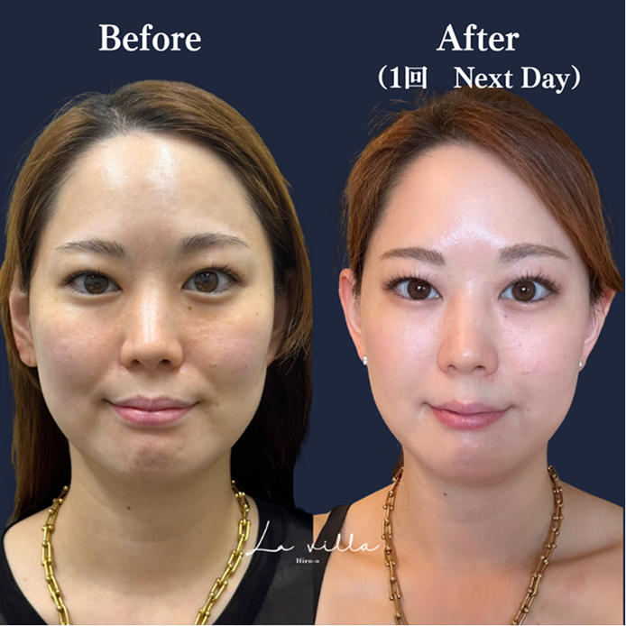 CASE 02 Before/After