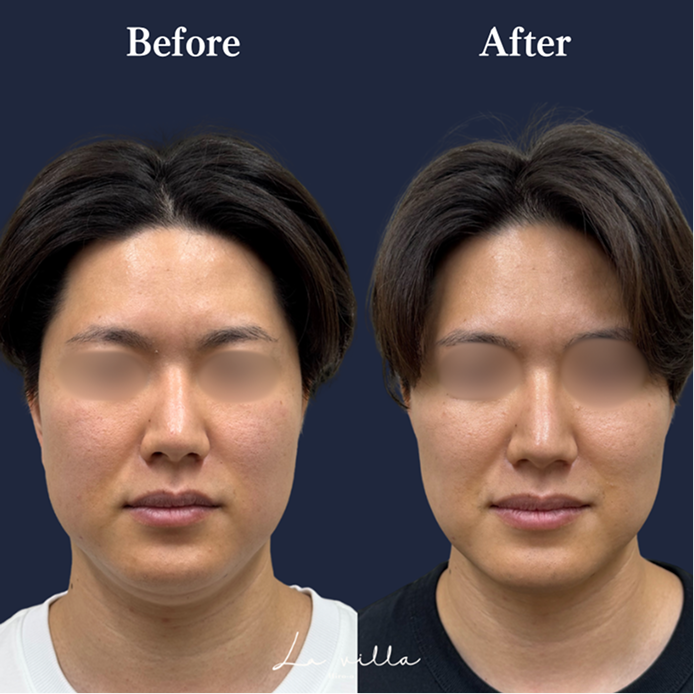 CASE 03 Before/After