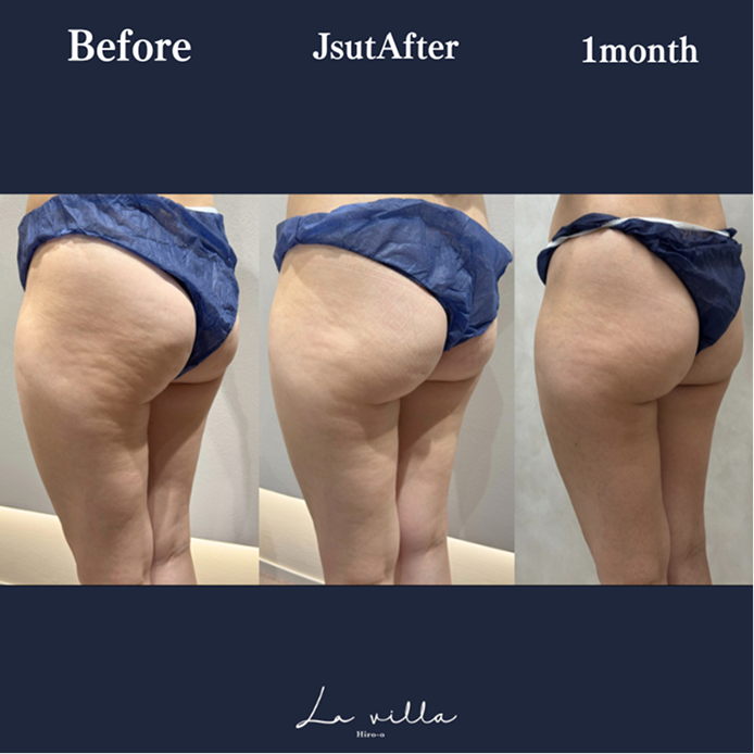 CASE 01 Before/After