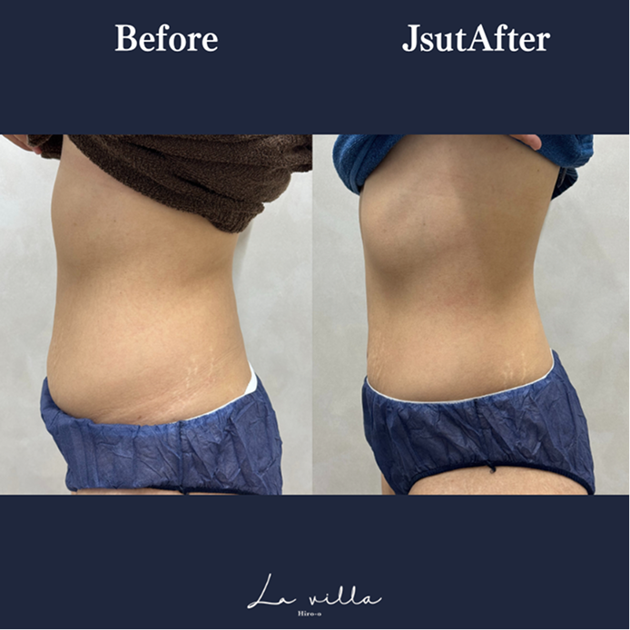 CASE 02 Before/After