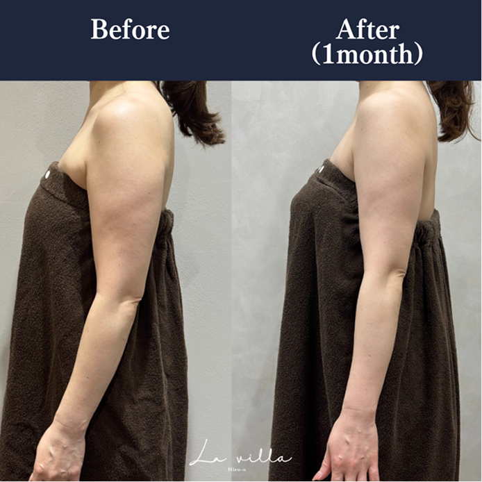 CASE 03 Before/After