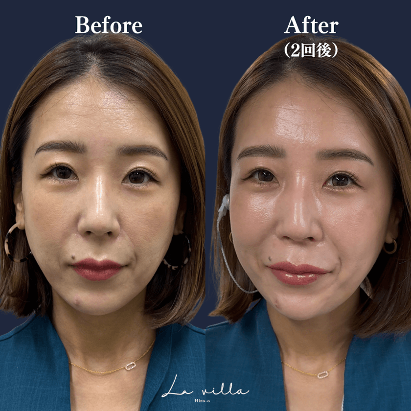 CASE 01 Before/After