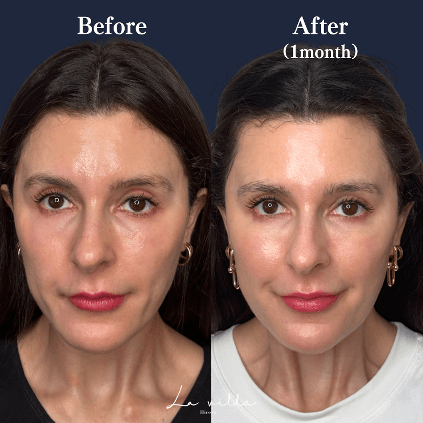 CASE 02 Before/After