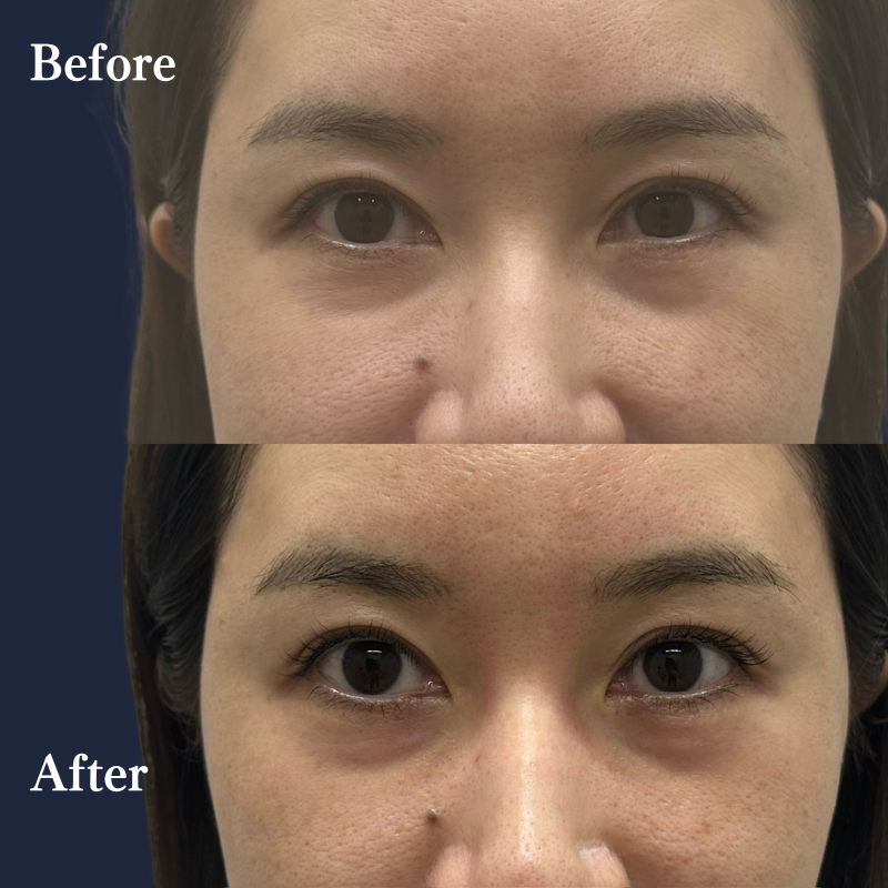 CASE 02 Before/After