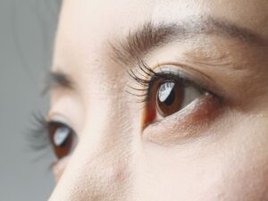 クマ取りの種類別｜悩みに合う施術と選び方ガイド