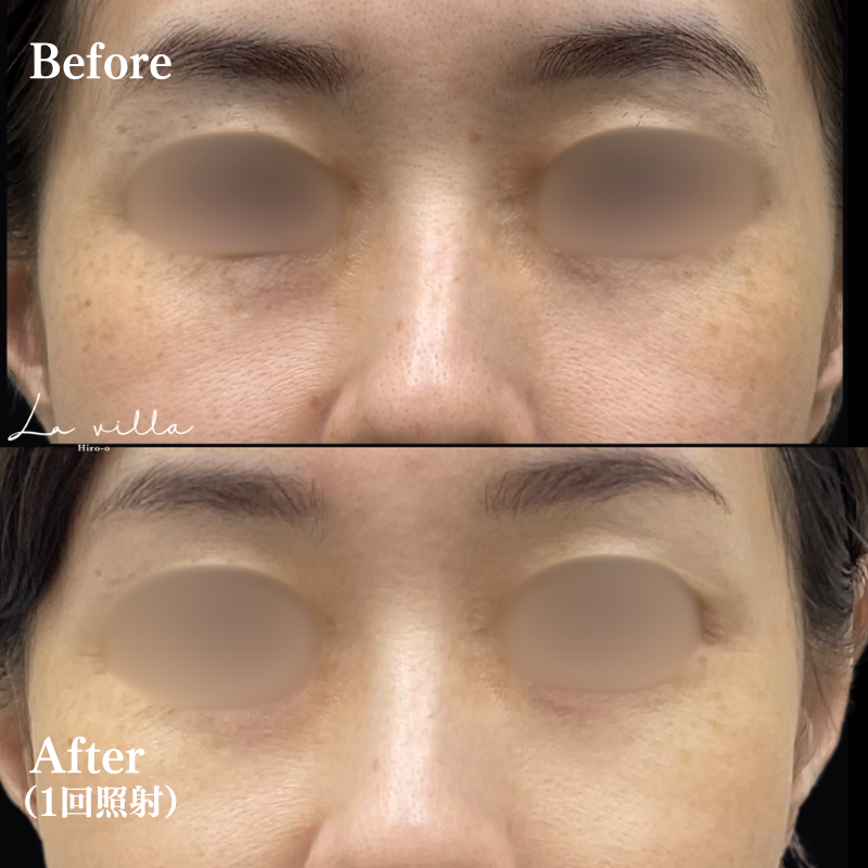 ルビーフラクショナル　No.167