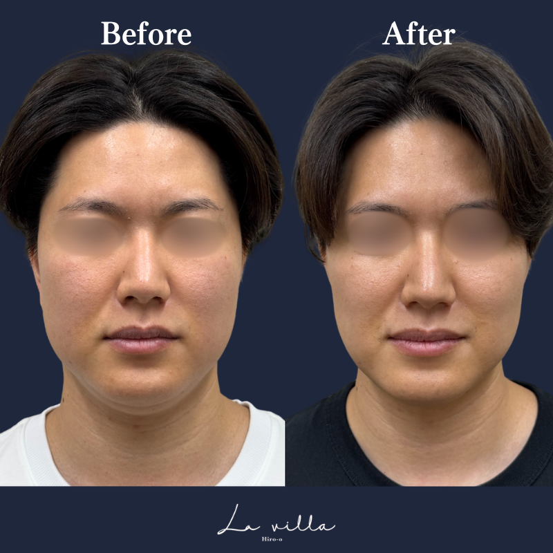 ボルニューマ×リヴァイブ No.95