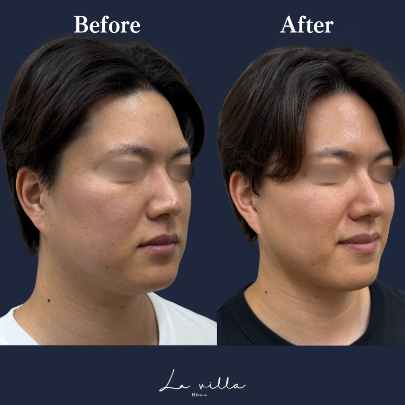 ボルニューマ×リヴァイブ No.95