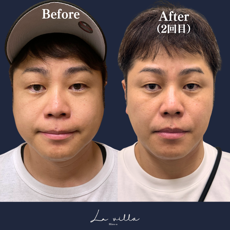 ボルニューマ×リヴァイブ No.166