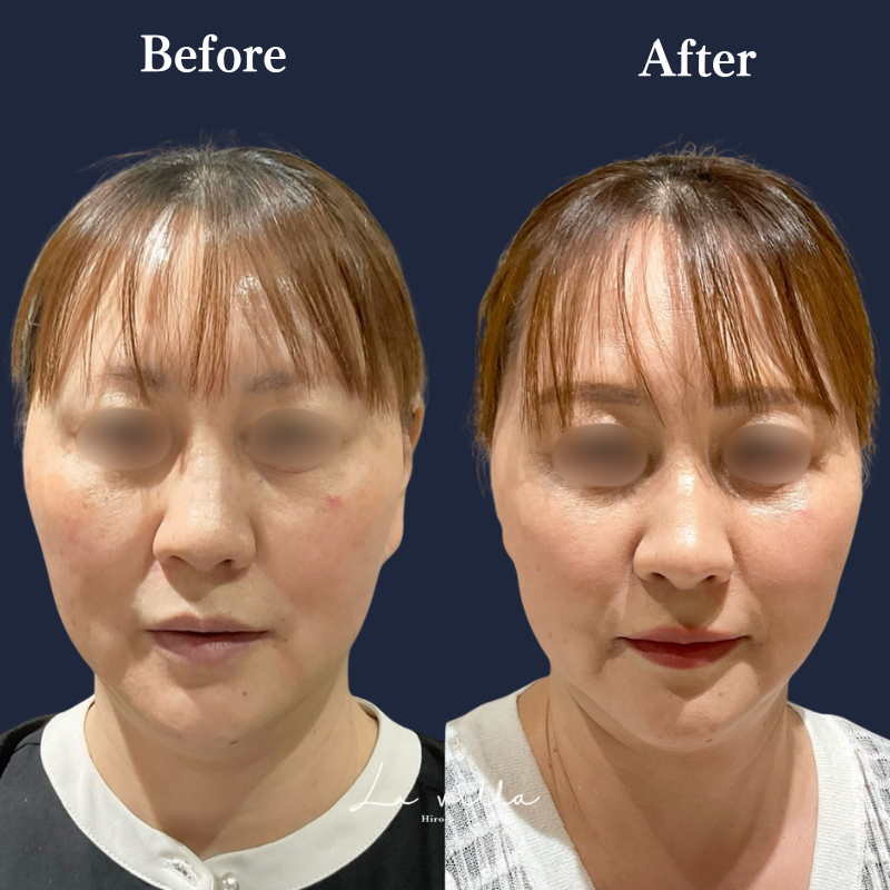 リヴァイブ  No.114