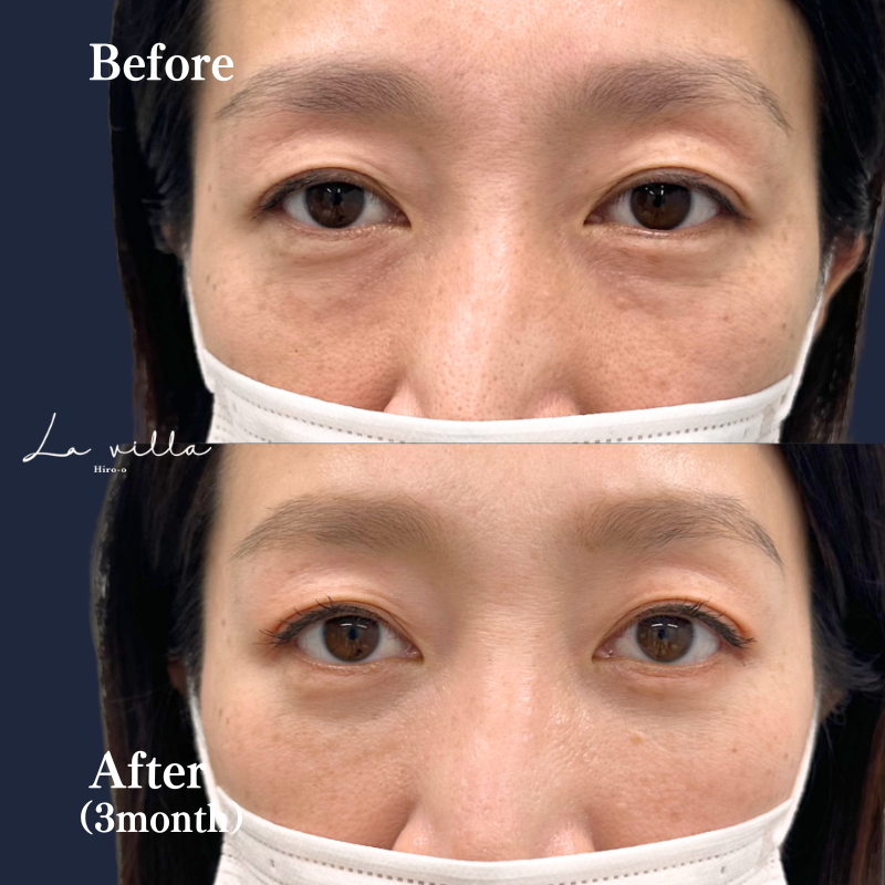 裏ハムラ　No.132