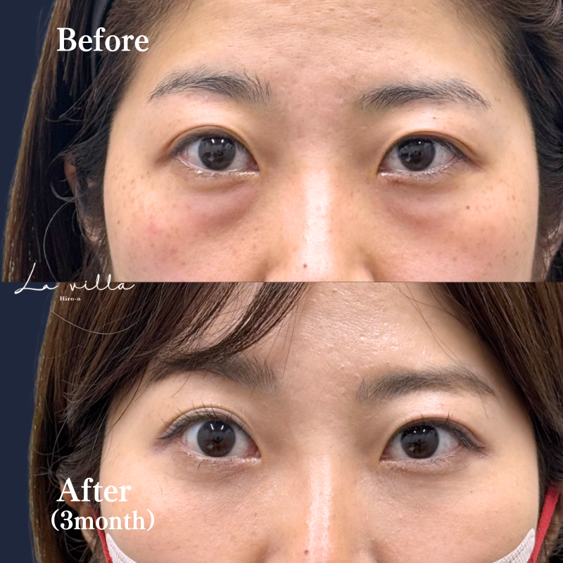 裏ハムラ　No.133