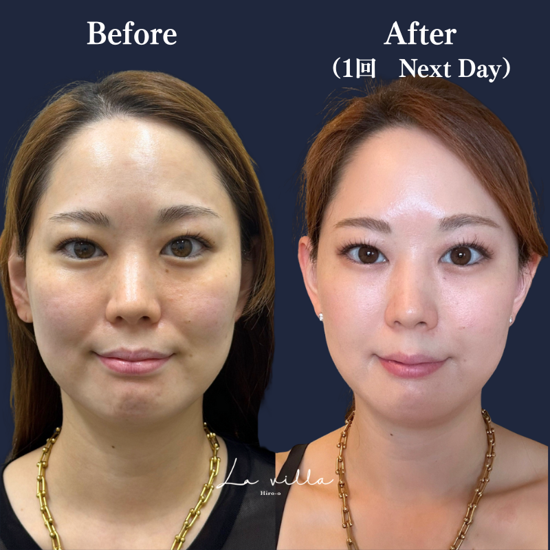 リヴァイブ No.120