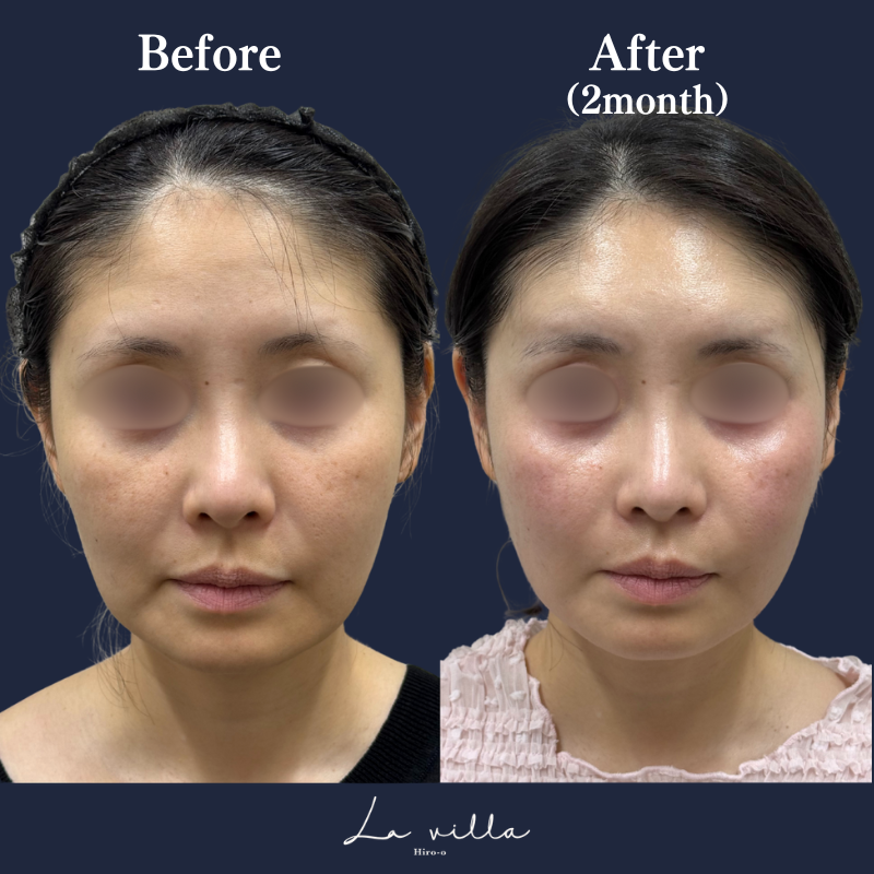 リヴァイブ 2回 No.121