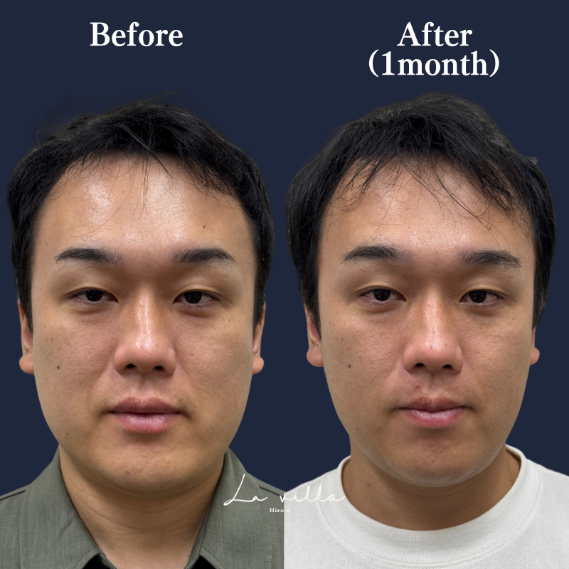 リヴァイブ　 No.126