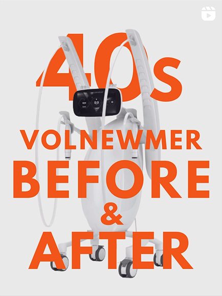 40s VOLNEWMER BEFORE AFTER