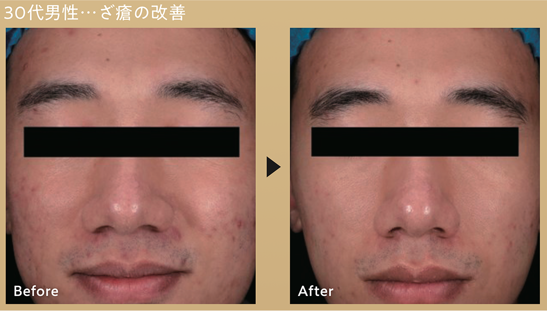 CASE 01 毛穴・肌質