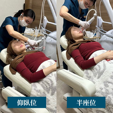 可動性の低い場所に注入