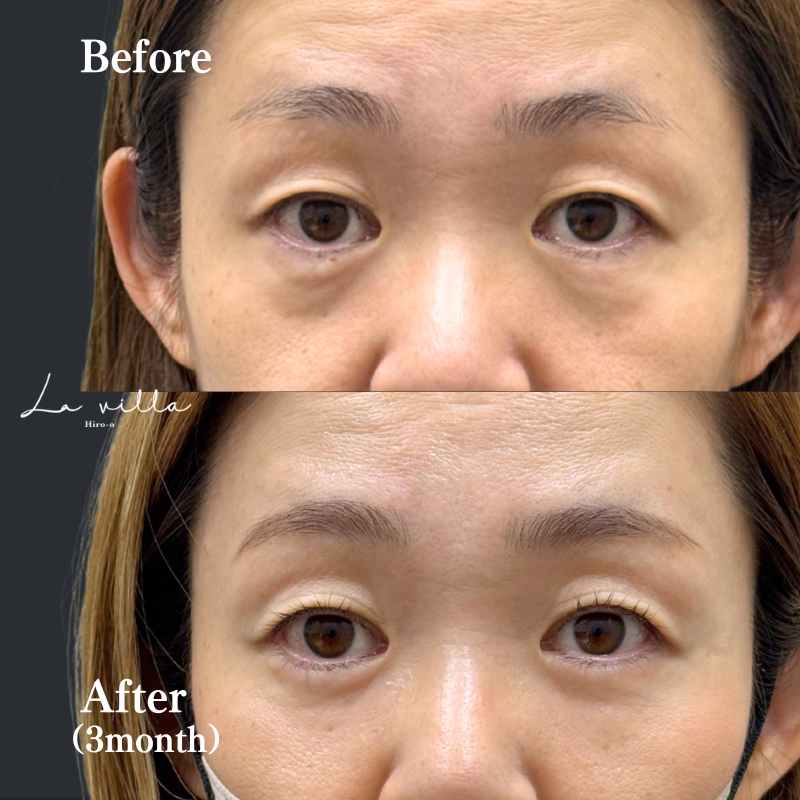 40代　表ハムラ　No.127