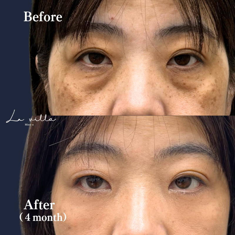 50代　表ハムラ　No.128