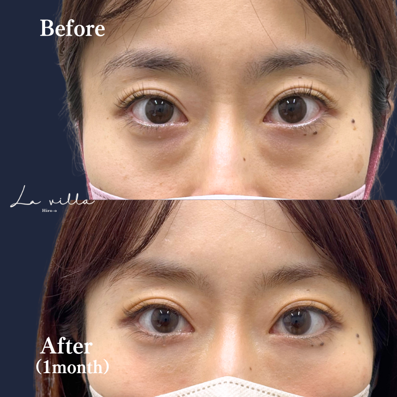 裏ハムラ　No.130