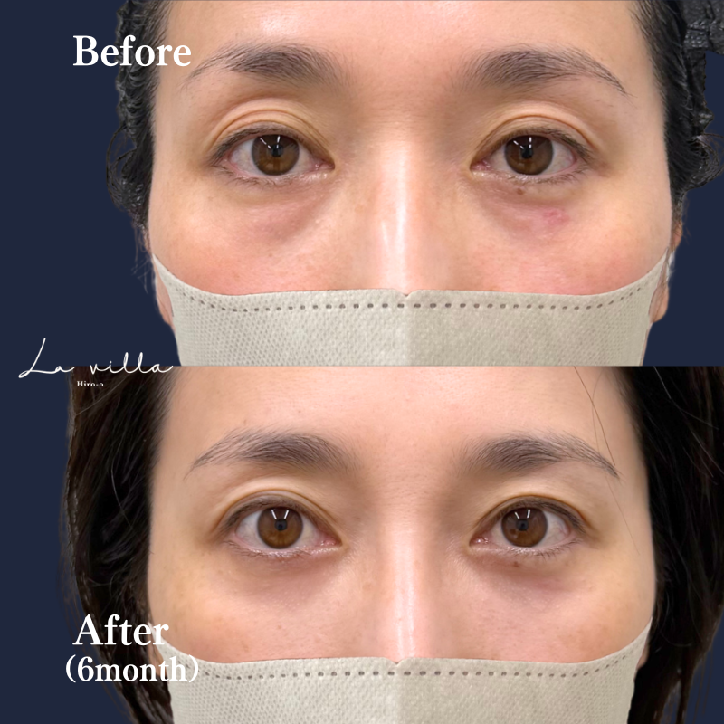 裏ハムラ　No.131