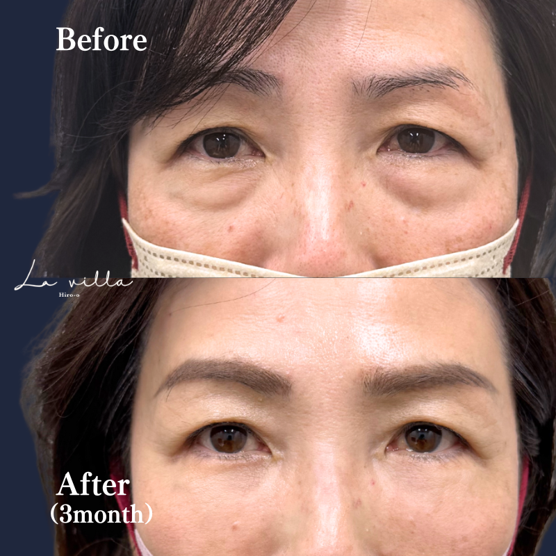 60代　表ハムラ　No.129