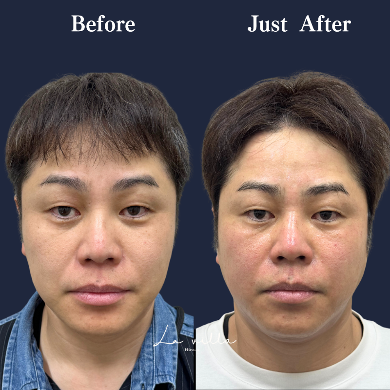 ブレッシング　No.232