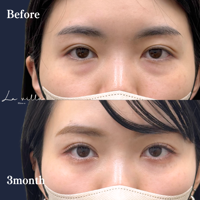 裏ハムラ　No.233