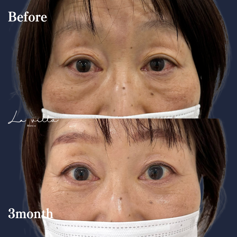 裏ハムラ　No.193