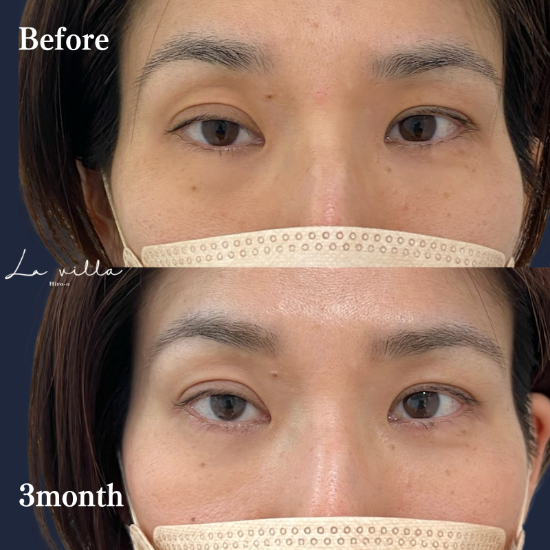 裏ハムラ　No.221