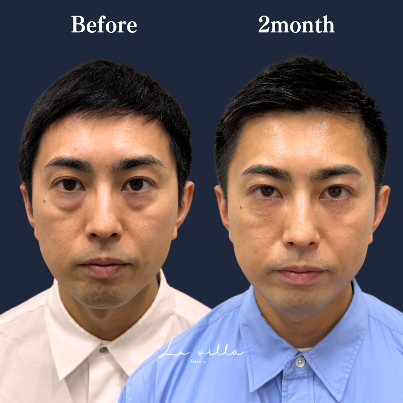 裏ハムラ　No.226