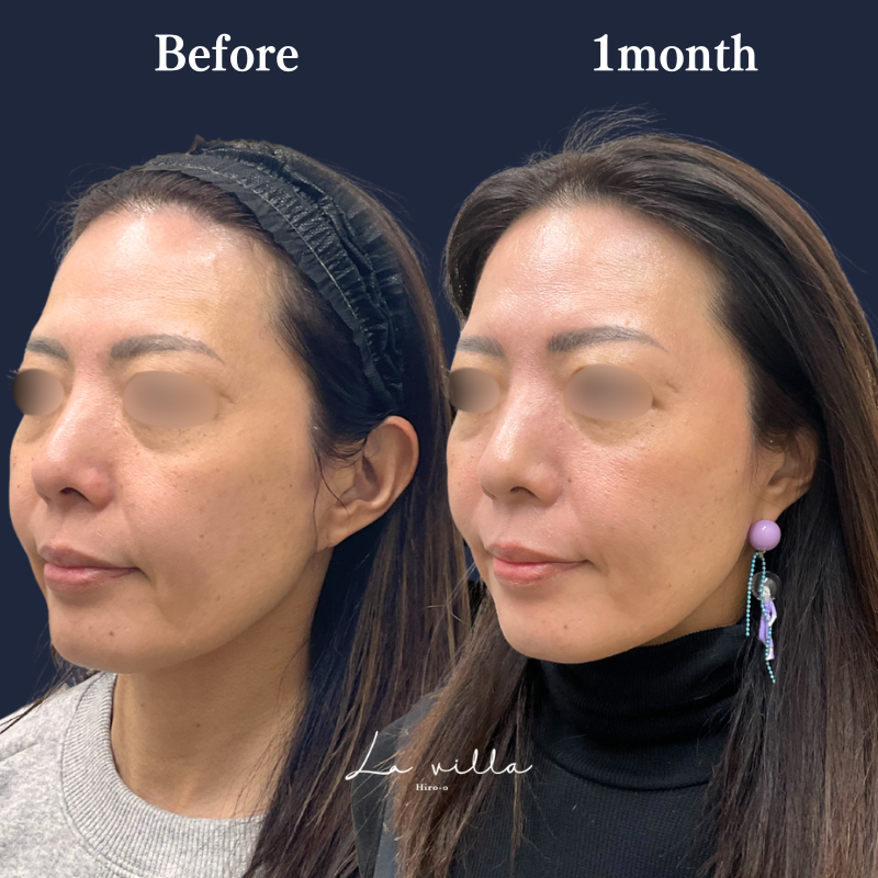 ボルニューマ No.230