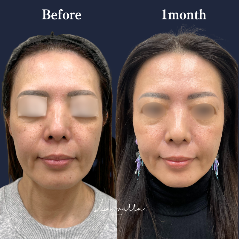 ボルニューマ No.230