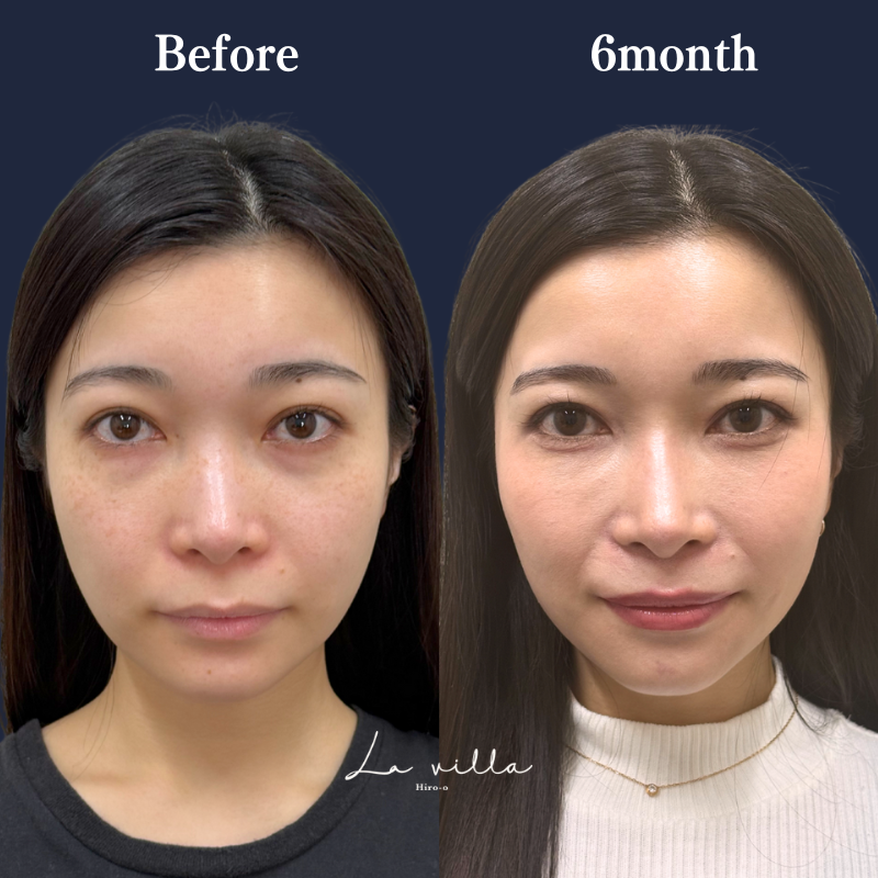 裏ハムラ　No.231