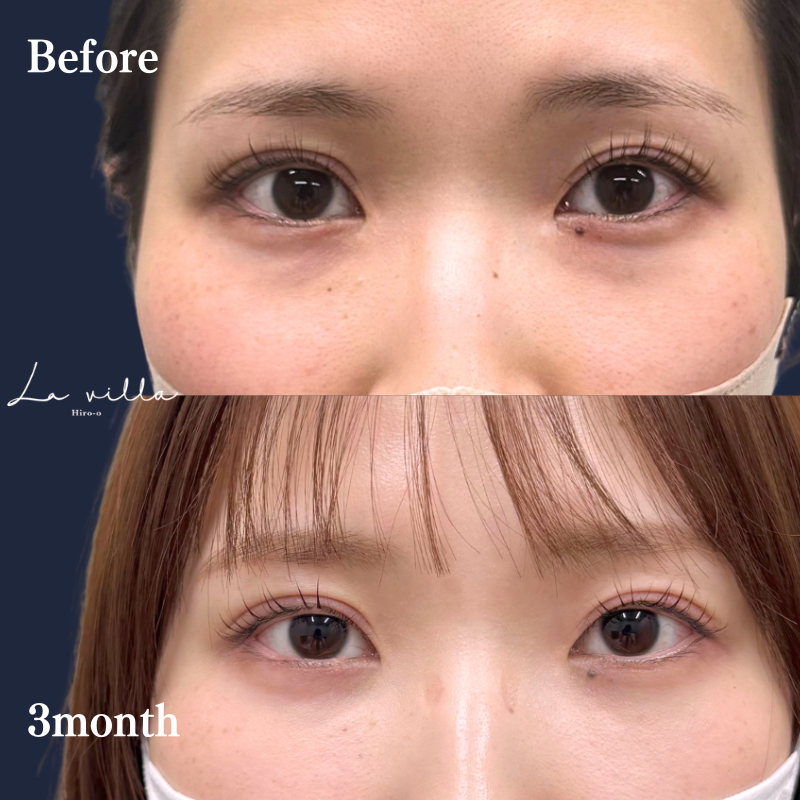 裏ハムラ　No.233