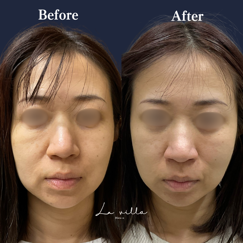 ボルニューマ No.179