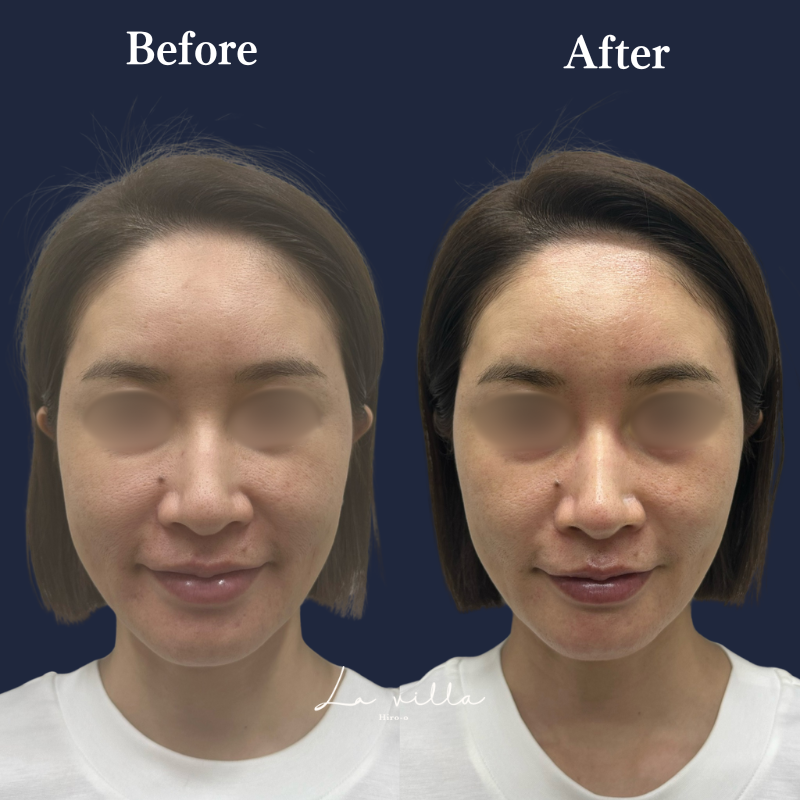 ボルニューマ No.180