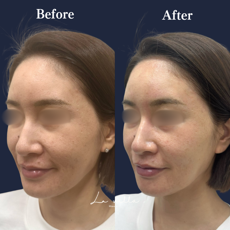 ボルニューマ No.180