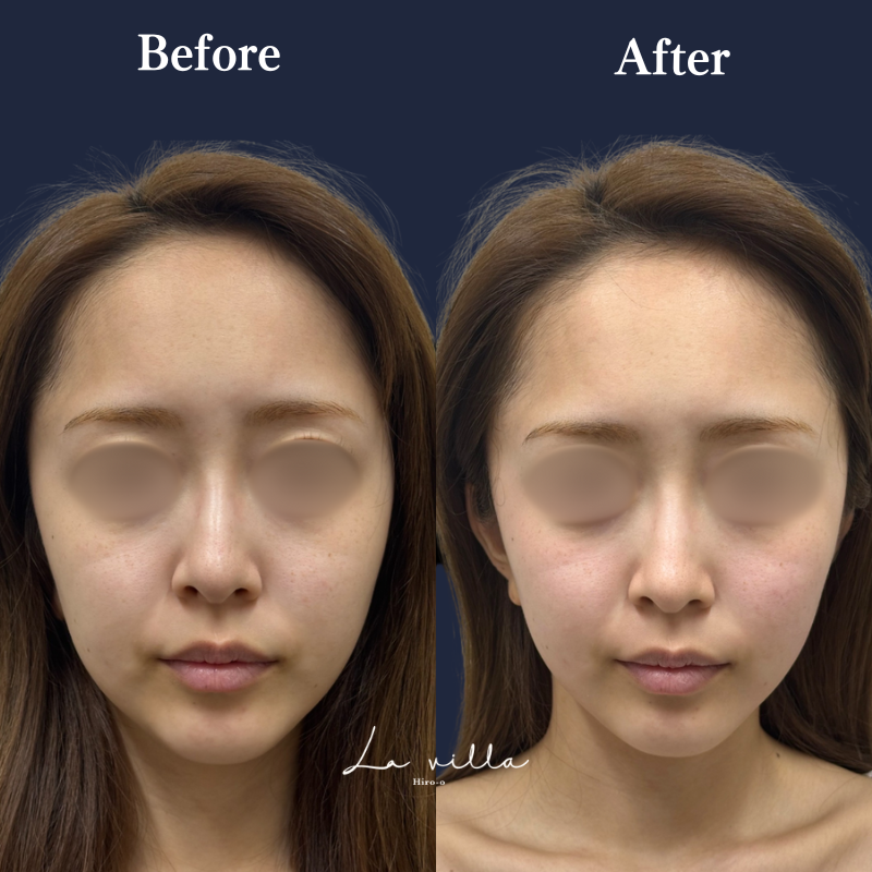 ボルニューマ No.181