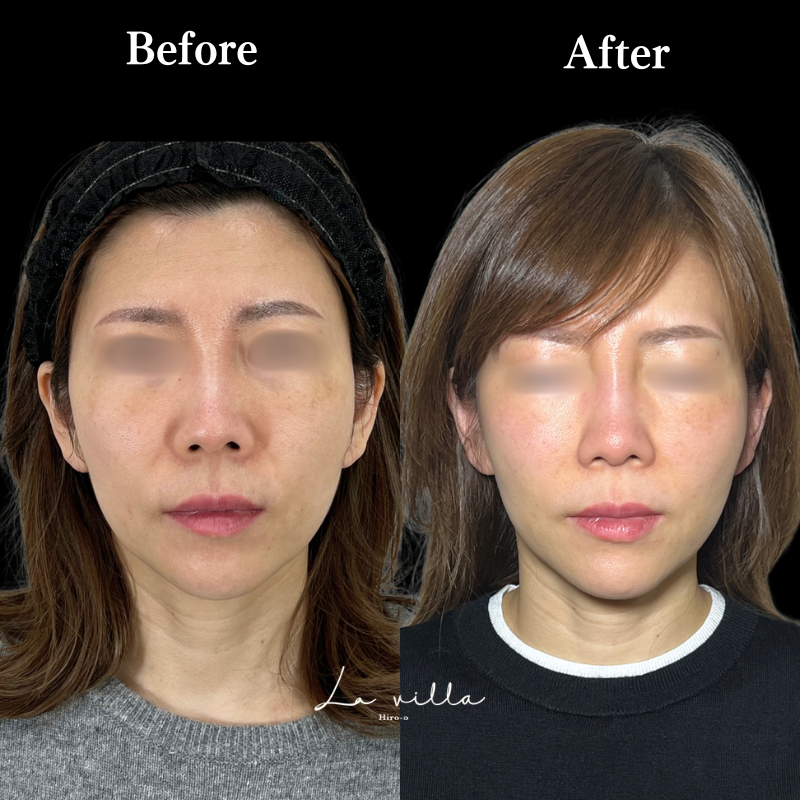 ボルニューマ No.182