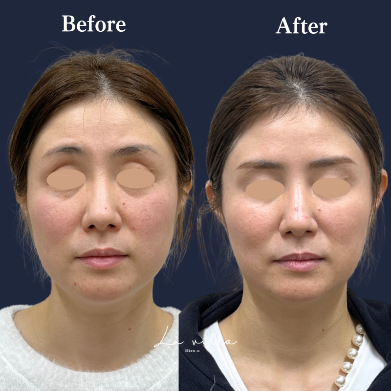 ボルニューマ No.183