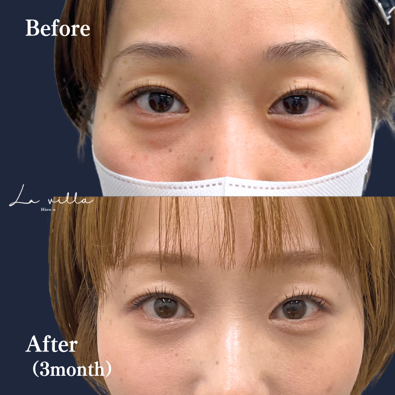 裏ハムラ　No.185