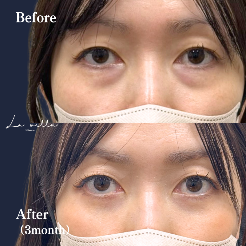 裏ハムラ　No.186