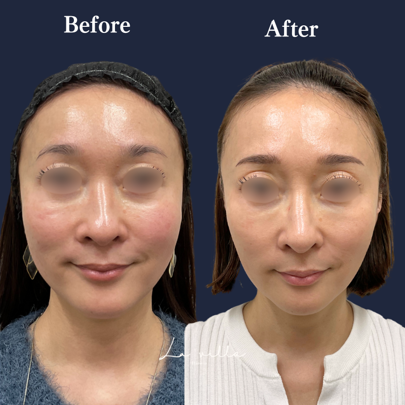 ボルニューマ No.189