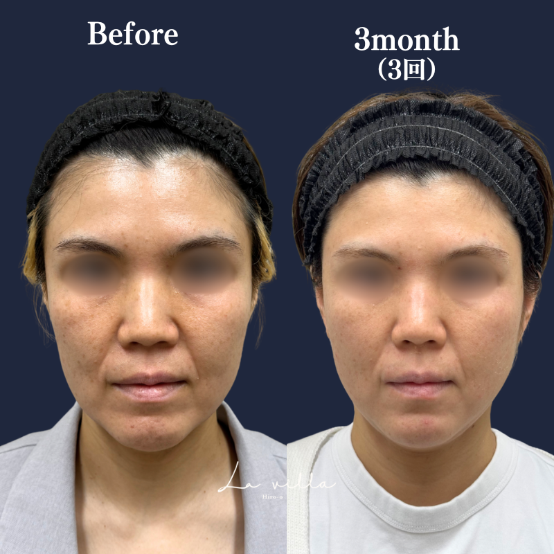 ボルニューマ×リヴァイブ No.192