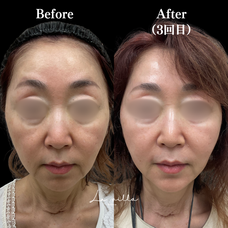 リヴァイブ　 No.171